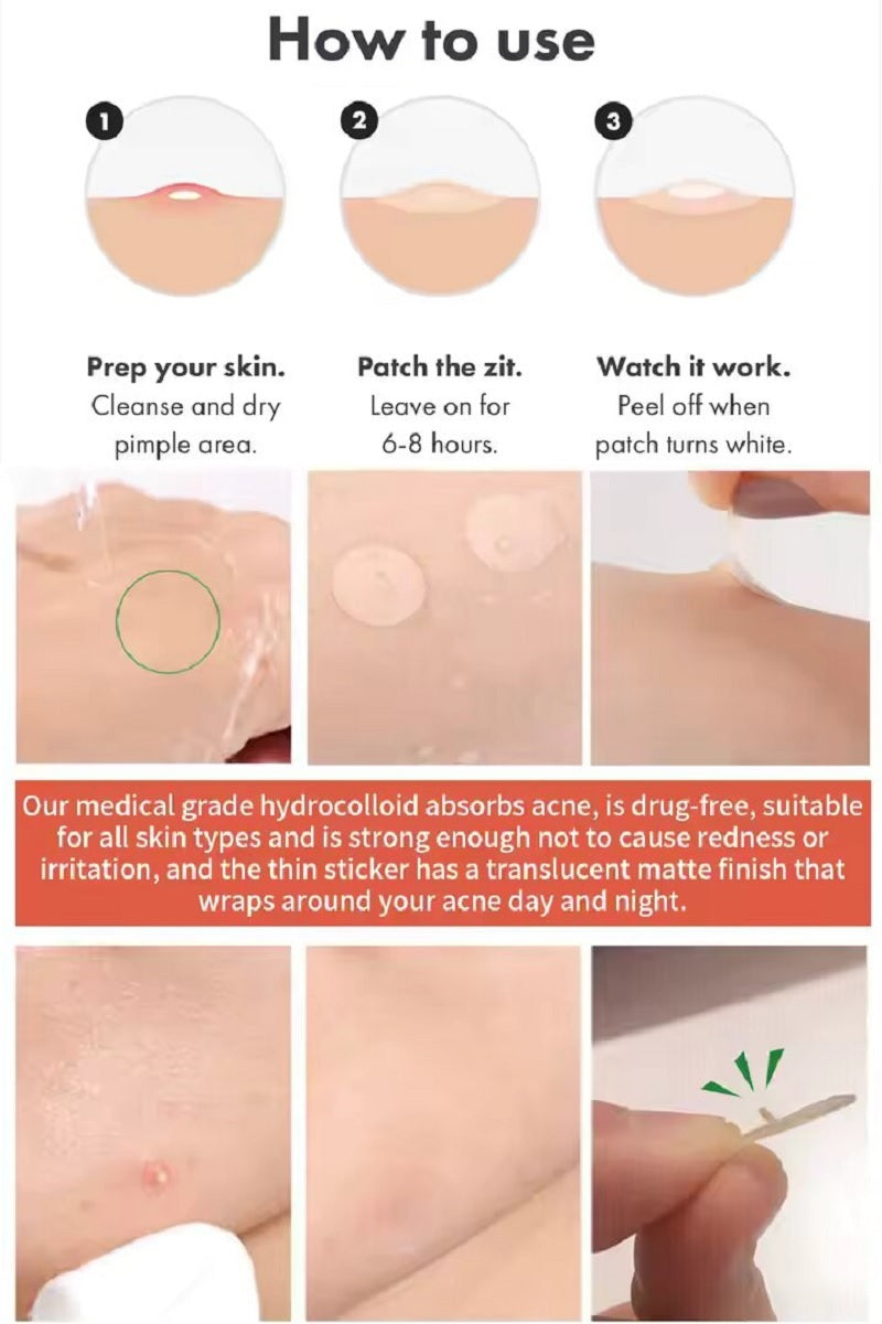 The Original Acne Patch 36 Count Box Clear Hydrocolloid Pimple Patches